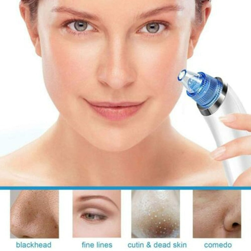 Blackhead Remover Vaccum Suction